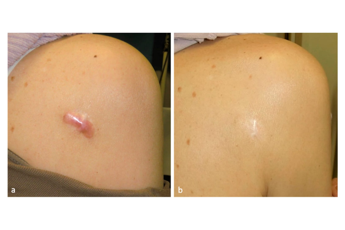 Patient photo shared with permission