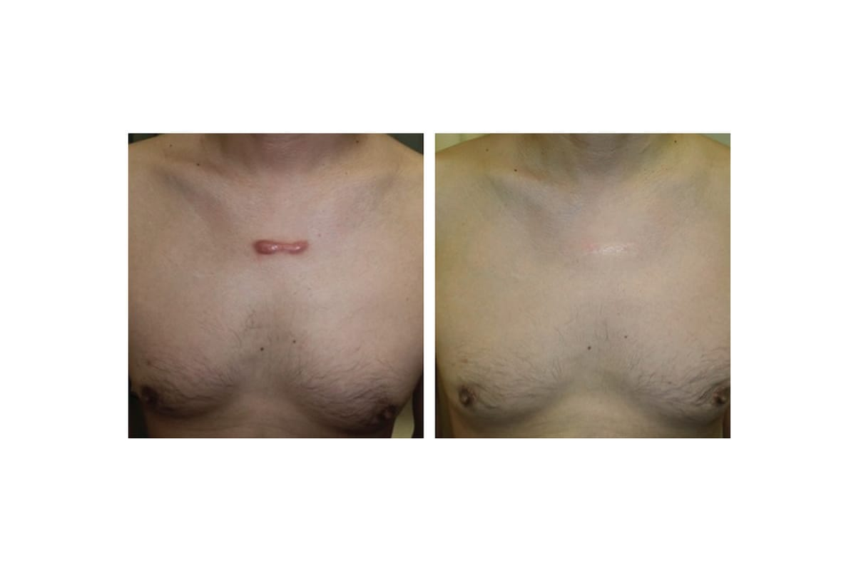 Patient photo shared with permission